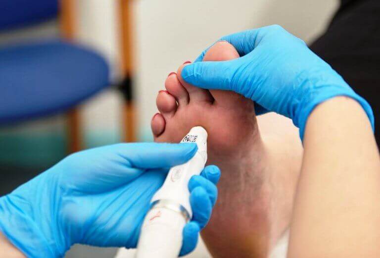 How to treat Verrucas? Round House Podiatry