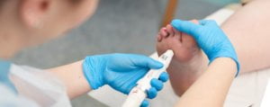 A patient having a verruca treated