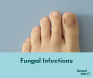 Feet closeup with fungal infections