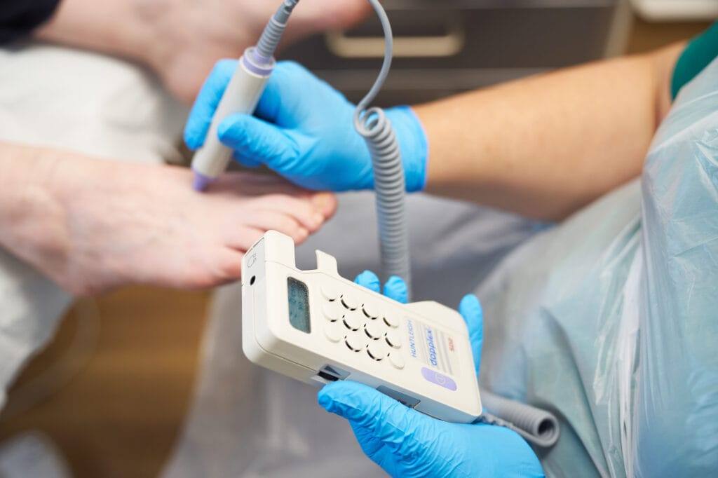 vascular checks carried out at your first appointment at round house podiatry huddersfield